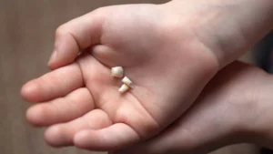 How Do You Store Baby Teeth